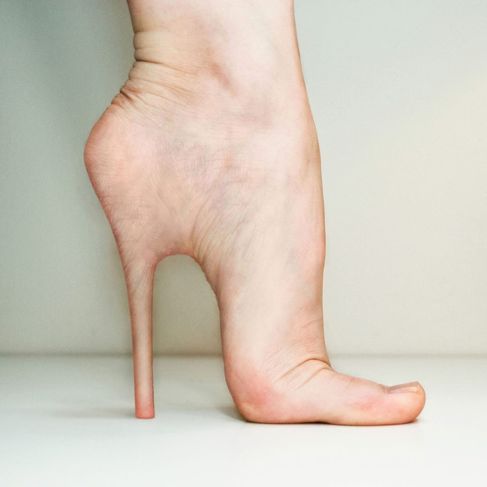 'Cinderella' Foot Plastic Surgery Cute Name Terrifying