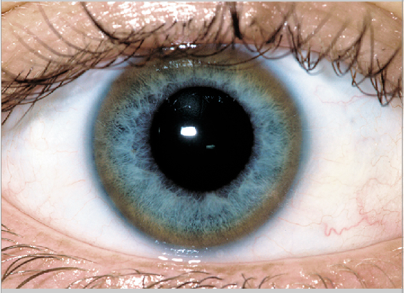 Do you have KayserFleischer rings?