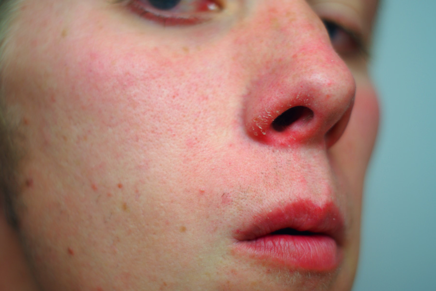 Oh My Nose Tellwut