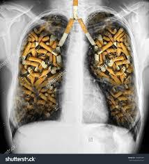 Cigarette smoking is the main cause of COPD. If you smoke, you are 12 times as likely to die of COPD as those who have never smoked. Have you ever been a cigarette smoker?