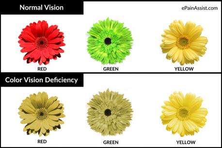 Which color blindness facts are you familiar with?