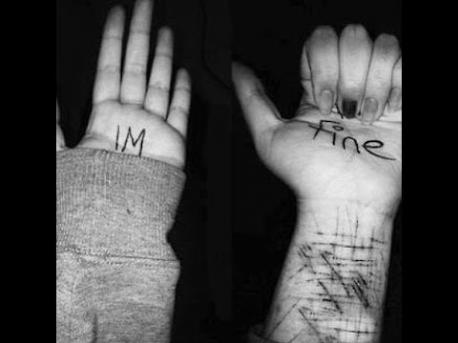 Self harm and specifically cutting is dangerous and highly misunderstood. Self-harm is the deliberate infliction of damage to your own body and includes cutting, burning, and other forms of injury. While cutting can look like attempted suicide, it's often not; most people who mutilate themselves do it as a way to regulate mood. People who hurt themselves in this way may be motivated by a need to distract themselves from inner turmoil or to quickly release anxiety that builds due to an inability to express intense emotions. This type of self-injury is an unhealthy way to cope with emotional pain, intense anger and frustration A common belief regarding self-harm is that it is an attention-seeking behaviour; however, in many cases, this is inaccurate. Many self-harmers are very self-conscious of their wounds and scars and feel guilty about their behaviour, leading them to go to great lengths to conceal their behaviour from others. In the movie, Camille wears long sleeves and pants, to try and conceal her scars. Do you know someone who you know or suspect may be self-harming (whether it be cutting, burning, etc)?