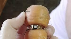 There was an interesting story in a survey last year about a Canadian woman from Alberta, who lost her wedding ring while gardening, only to find it 13 years later in that same garden plot, with a carrot grown around it. As odd as that might be, it's not an isolated occurrence. A German man found his lost wedding ring wrapped around a carrot, after losing it 3 years earlier and a Swedish woman also found her ring wrapped around a carrot, after it was missing for 16 years. In other lost ring stories (not carrot related), here are some unusual stories of lost rings and the strange places they end up. Have you ever heard any of these before?