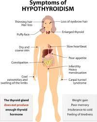As we age, many of the symptoms of an underactive thyroid or hypothyroidism, the most common thyroid disorder, and one that is often undiagnosed or misdiagnosed, are seen as part of the aging process, and often not checked into. If you are experiencing many of these and especially all of these, you may want to consult a medical specialist and have them do blood work to check for hypothyroidism. Have you ever experienced any or all of these symptoms?