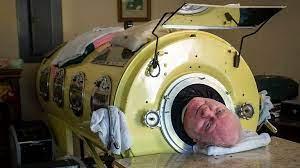 Paul Alexander, an American man who spent more than 70 years living in an iron lung, died March 11. He was 78. Alexander, who was also known online as 'Iron Lung Man,' spent the last seven decades of his life living in an iron lung after contracting polio when he was a child in the 1950s. The Dallas, Texas resident was diagnosed with polio when he was 6 years old and was paralyzed from the neck down, leaving him unable to breathe on his own. Despite being confined to a 600-pound iron lung, Alexander obtained his law degree, passed the bar to become a lawyer and wrote a book, all while his entire body, except his head, was immobilized in the machine. Alexander's positive attitude, despite his condition, was an inspiration to many. Are you surprised how much he accomplished confined to an iron lung?