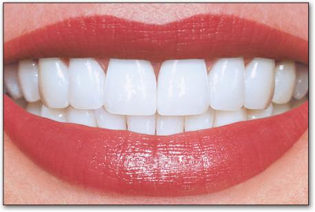 Do you get your teeth cleaned every 6 months?