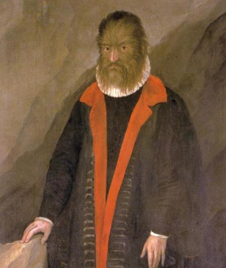 Gonsalvus was so successful that he became a treasured member of the royal court. Of course, he was treated like a novelty, but he was a nobleman nonetheless, meaning he got to live a pretty nice life. That is, until Catherine de' Medici came along. King Henry II's wife took over the throne after he passed away, and she wasn't exactly known for being a nice person. Accounts vary as to why exactly she wanted to find a wife for Gonsalvus — some say she found the idea of marrying him off to a beautiful woman
