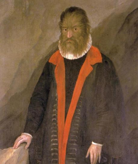 Gonsalvus was so successful that he became a treasured member of the royal court. Of course, he was treated like a novelty, but he was a nobleman nonetheless, meaning he got to live a pretty nice life. That is, until Catherine de' Medici came along. King Henry II's wife took over the throne after he passed away, and she wasn't exactly known for being a nice person. Accounts vary as to why exactly she wanted to find a wife for Gonsalvus — some say she found the idea of marrying him off to a beautiful woman 