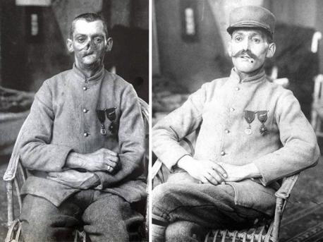 The so-called mutilés were so wounded, some of their faces were barely recognizable. Was any of your family members serving during WW1?