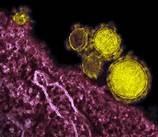 Saudi Arabia has been the center of an outbreak of Middle East Respiratory Syndrome (MERS) which first surfaced two years ago. At least 400 cases have been reported, and more than 100 people have died. Cases of MERS have spiked recently, causing concern among international health organizations. Have you heard about MERS?
