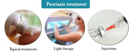 What various treatments are you familiar with for psoriasis?