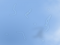 Do you see floaters in your eyes? (see picture for example on how they look)