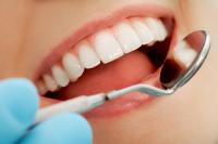 Do you brush your teeth after each meal?