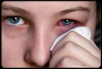 Have you or someone you know ever had pink eye?