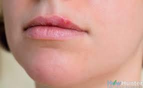 Do you ever get cold sores? I never did but I have had a few in the last 10 years.