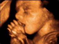 Have you ever heard of a 4D ultrasound?
