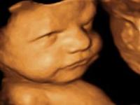 Do you know much about 4D ultrasounds?