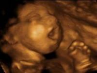 4D ultrasounds are done the same way 3D ultrasounds are. They are a live action view of your (or a) baby and what it is up to inside of the mother. You can watch them move around, open their eyes, suck on their thumbs, etc. Knowing this, would this be of interest to you to learn more about?