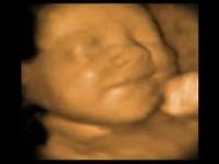Would you like consider doing a 4D ultrasound in the future? (Men, imagine this with your wife)
