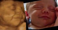Would you prefer 3D ultrasound or 4D ultrasound?