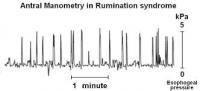 Thinking about times when you are ruminating, have any events happened to you from the first question?(Don't think too long about this question).