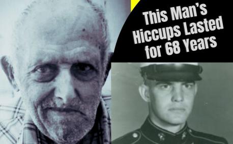 There's the strange case of Charles Osborne, who was afflicted with a continuous case of hiccups for 68 years, recognized by Guinness World Records as the longest case of hiccups in history. Osborne's story began with an accident on June 13, 1922, in which he accidentally slipped and fell. His doctor later said he popped a blood vessel in his brain the size of a pin, and theorized that Osborne must have damaged the incredibly small area of the brain that controls and inhibits hiccups. Have you ever heard of this unfortunate record set by Charles Osborne?