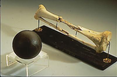 During the assault by Lieutenant General James Longstreet's Confederate troops, Sickles' leg was struck by a cannonball and mangled beyond repair. He was carried off the field in a litter and his leg was amputated above the knee. Having heard that the Surgeon General had requested