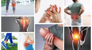 On a typical day, how would you describe your arthritis pain?