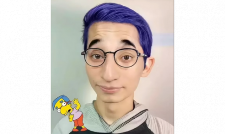 The human version of Milhouse was a spitting image of his cartoon self. Do you think this is a good image?