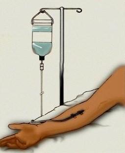 Have you ever had an intravenous (IV) injection?