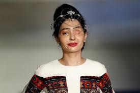 19-year-old Reshma Quereshi, whose face got disfigured in an acid attack is now changing the 