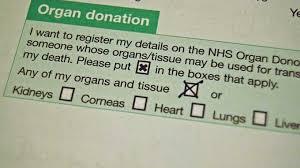 Do you think Canada and the United States should also make it automatic to be an organ donor (with an opt-out option)?